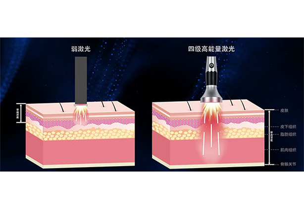 动物激光理疗仪